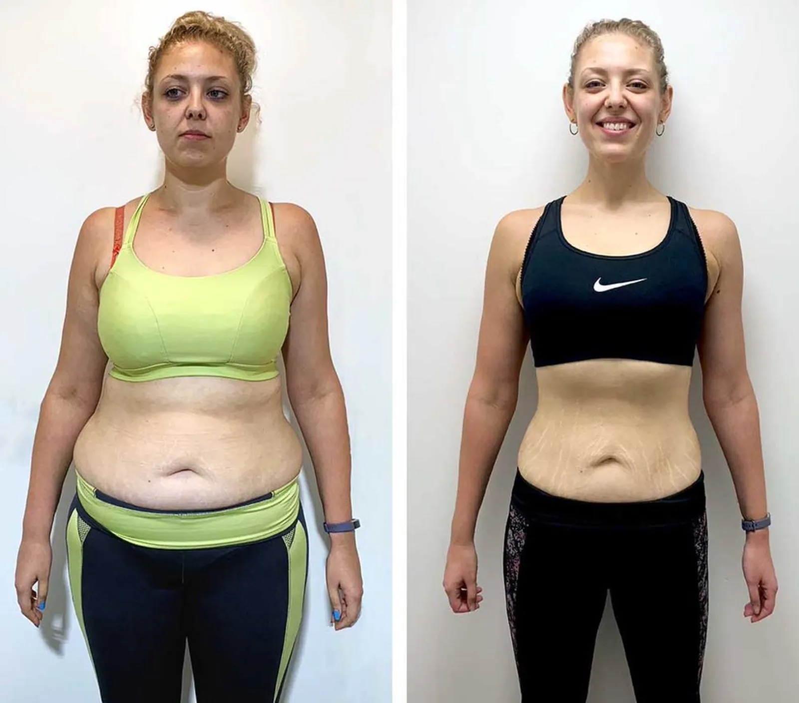 Jennifer transformation
