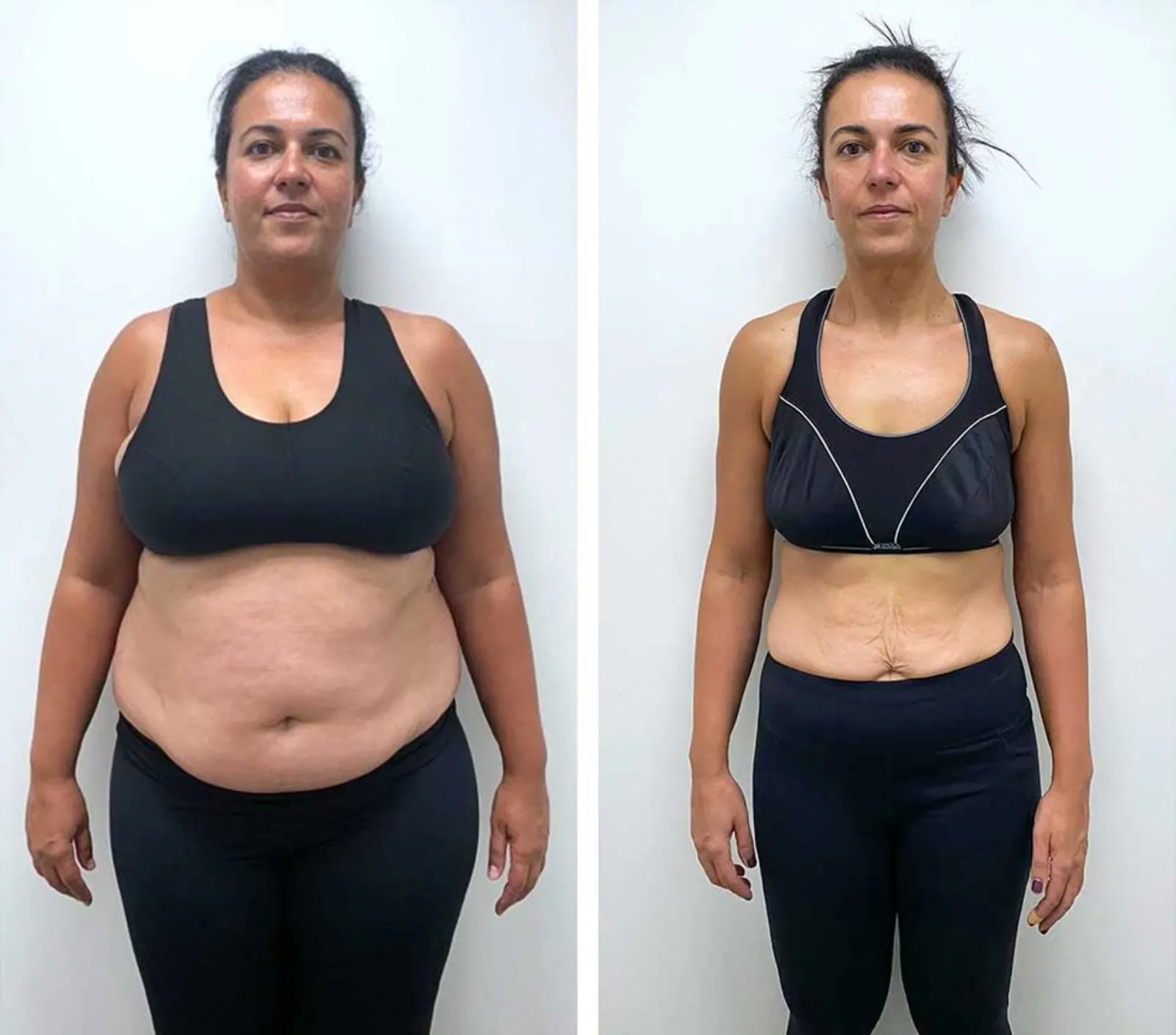 Valerie transformation